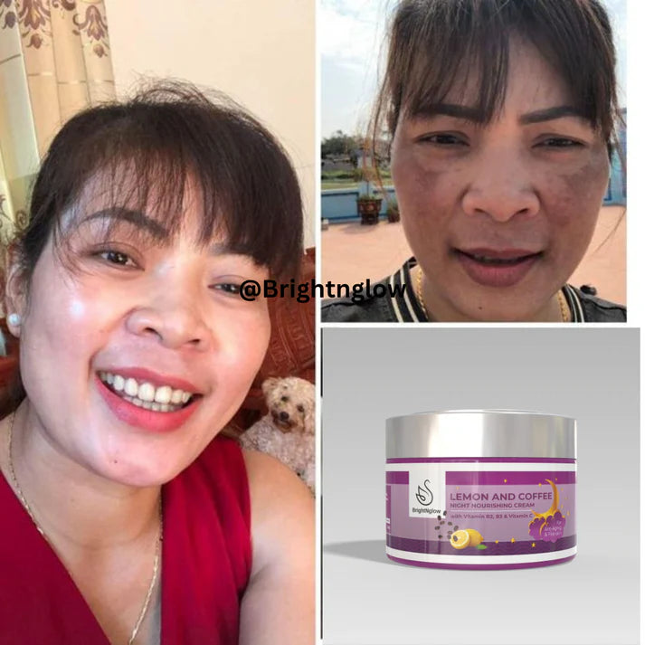BrightNglow Day and Night cream Combo