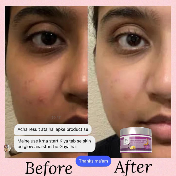 BrightNglow Day and Night cream Combo