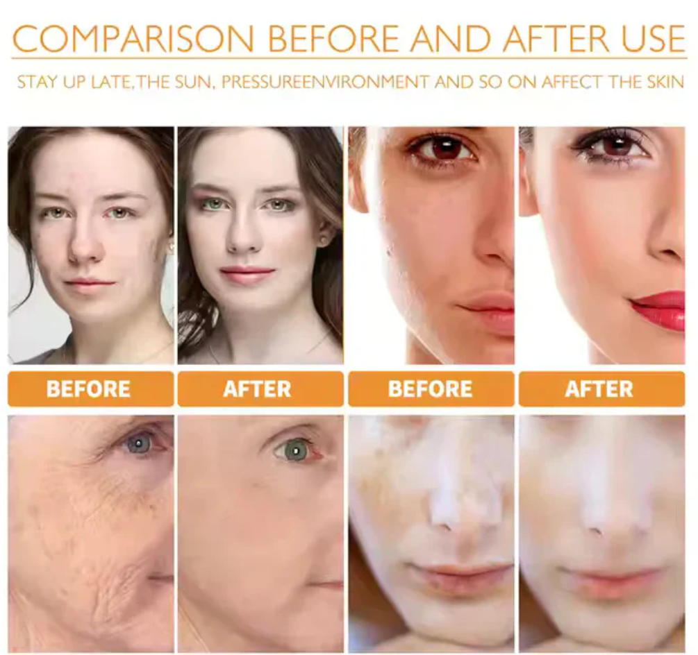 10% Vitamin C Face Serum For Daily Brightness