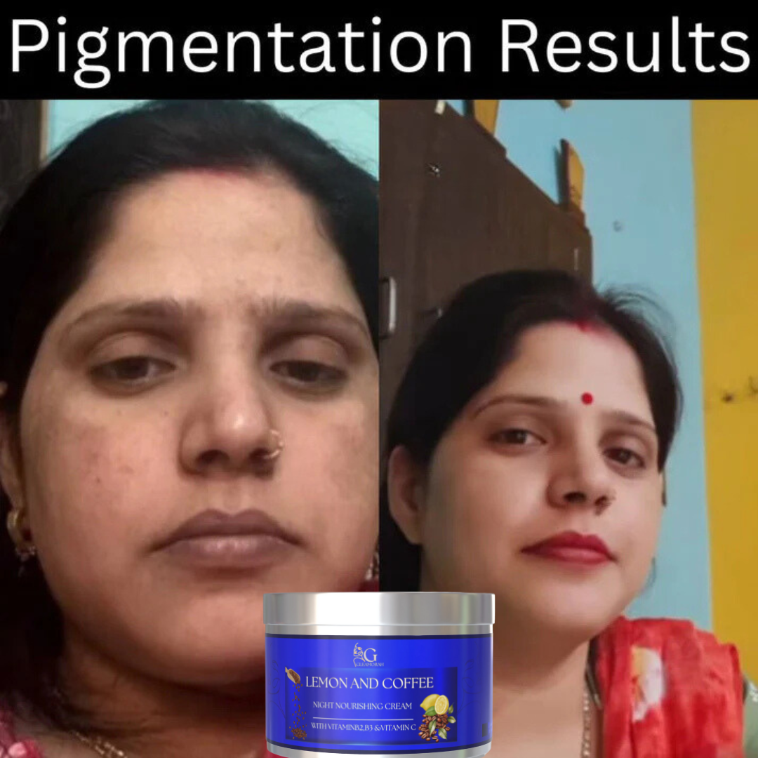 Day and Night cream combo