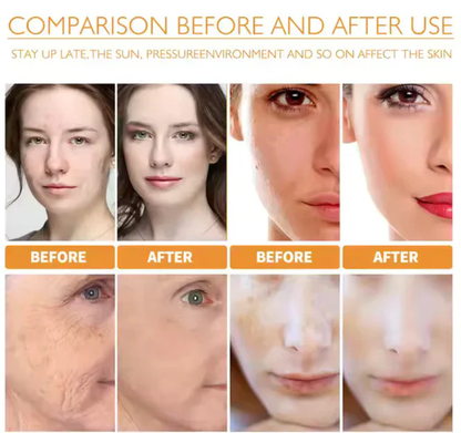 10% Vitamin C Face Serum For Daily Brightness