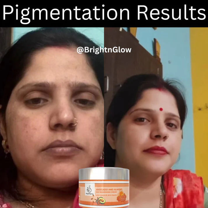 BrightNglow Day and Night cream Combo